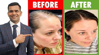 3 Home Remedies To Prevent Hair loss And Regrow Your Hair [upl. by Eentrok]