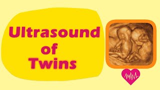 Sonography of Twins [upl. by Klina]