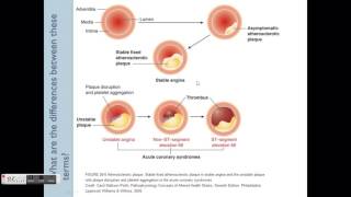 Angina Pathophysiology amp Treatment overview [upl. by Parthenia]