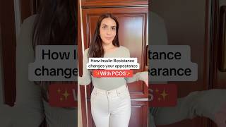 How Insulin Resistance changes your appearance with pcos [upl. by Lachance]