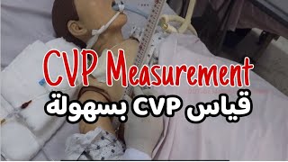 CVP procedure ENAR  CVP طريقة قياس [upl. by Steady]