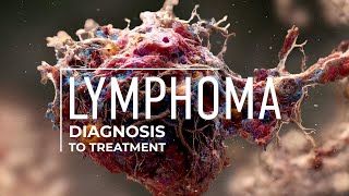 Exploring Lymphoma Treatment Options [upl. by Anomer]