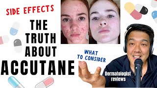 ACCUTANE  Dermatologist Review Unbiased [upl. by Cadell]