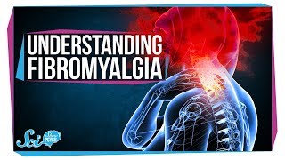 Real Pain and Explosive Brains  Fibromyalgia [upl. by Iznek]