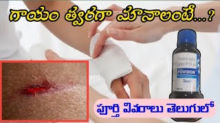 Povidone Iodine Solution Uses In Telugu  Antiseptic  Microbicidal Solution [upl. by Buckingham]