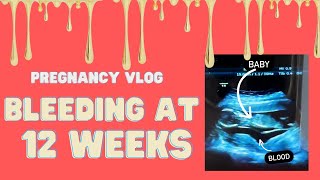 VLOG  BLEEDING IN PREGNANCY  Miscarriage scare  Subchorionic Hemorrhage Hematoma pt 1 [upl. by Susy630]