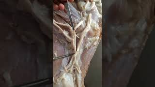 Arteries of forelimb of Ox [upl. by Einwahs]