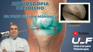 ARTROSCOPIA DE JOELHO  Dr Prof Nelson Mrques [upl. by Einnalem]