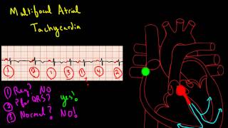 Atrial Arrhythmias How to Read an EKG Curriculum [upl. by Feinleib]