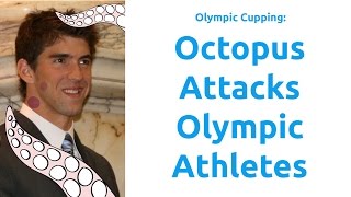 Olympic Cupping Octopus Attacks Olympic Athletes Fascia [upl. by Ellerrad603]