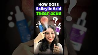 How does Salicylic acid treat acne acne salicylicacid serum csirnet neet biology sciencefact [upl. by Notnroht448]