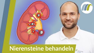 Nierensteine Wie bemerkt amp behandelt man sie richtig  Urologie am Ring [upl. by Rumney]