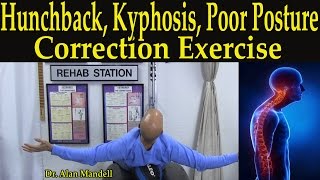 Hunchback Kyphosis Poor Posture amp Hip Flexor Stretch Correction Exercise 2 Parts  Dr Mandell [upl. by Poland22]