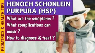 Henoch Schonlein Purpura HSP Causes Symptoms Diagnosis amp Treatment In Pediatrics [upl. by Aitan]