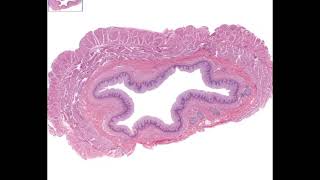 Histology esophagus [upl. by Eissoj172]