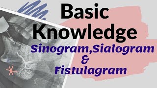 Basic knowledge of Sinogram Sialogram amp Fistulagram Ep51 Sinography  SialogramFistulagraphy [upl. by Keese]