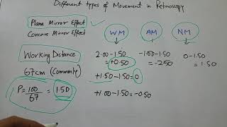 Different types of movement in Retinoscopy [upl. by Sucerdor995]