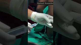 Spinal anaesthesia proceduresdoctornursingmotivationshortvideoviralvideo [upl. by Ozzie]