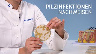 Hautpilz erkennen  So funktionert der Nachweis │Dr med Alice Martin [upl. by Joost]