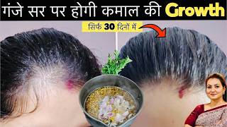 30 Days Extreme Hair Growth Challenge Most Powerful Ingredients To Grow Faster Longer Thicker Hair [upl. by Arval460]