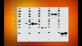 Western Blot Conceptos Básicos [upl. by Euqitsym477]