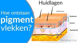 PIGMENTVLEKKEN  Hoe ontstaan pigmentvlekken  Wat zijn pigmentvlekken [upl. by Alegnasor592]