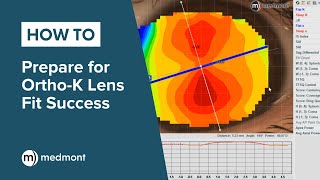 HowTo  Prepare for OrthoK lens fit success [upl. by Early]