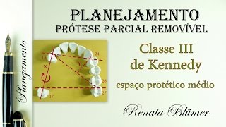 PPR  PLANEJAMENTO CLASSE III DE KENNEDY médio [upl. by Cinderella]