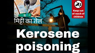 Kerosene Poisoning Dos amp Dont s  Mitti ka tel Hai khatarnak  First aid management [upl. by Analise]