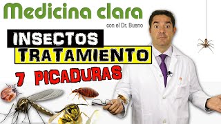 7 PICADURAS de INSECTOS TRATAMIENTO  Especial ATENCIÓN a las 2 ÚLTIMAS  Medicina Clara [upl. by Nairadal]