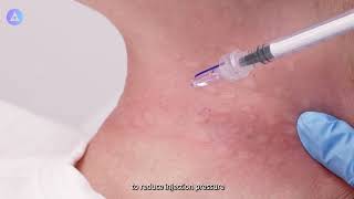 MicronJet™ Intradermal Delivery to the Neck Area Training Video [upl. by Ruelu]