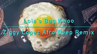 TRLER Lolas Bag Kwoo Ziggy Lopez Afro Deep Remix [upl. by Cathrine]