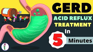 GERD Treatment  Acid Reflux Treatment  Heartburn Treatment  All You Need to Know [upl. by Editha]