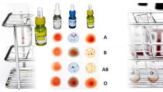 Terapia Transfusional Pruebas cruzadas [upl. by Euqinobe]