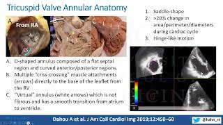 Novel Concepts of Tricuspid Regurgitation Anatomy Pathophysiology and Management [upl. by Steen658]