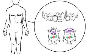 Stage IV Melanoma Cancer Treatment Options Explained Immunotherapy and Targeted Therapy [upl. by Ileray]