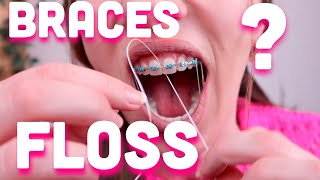 How to floss between your braces [upl. by Edy]