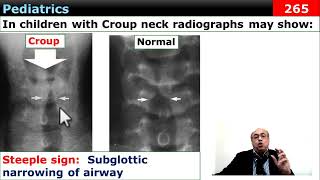 internalmedicine cme usmle محاضراتباطنة ecg كورساتباطنة clinical clinical medicine [upl. by Bundy]