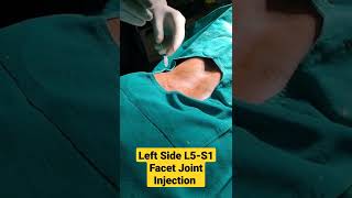 Left Side L5S1 Facet Joint Injection under CArmDr Sai Chandra MBBS DNB Ortho [upl. by Kriste568]