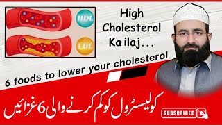 High Cholesterol ka Ilaj In UrduHindi l High CholesterolLDL Symptoms Causes and Treatment [upl. by Dachia]