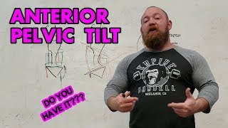 Part I What is Anterior Pelvic Tilt How it Can Affect Your Lifts and How to Know if You Have It [upl. by Ogden121]