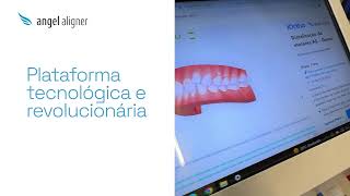 Levando tecnologia ao munto inteiro  Angel Aligner Brasil [upl. by Dougy]