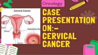 Case Presentation On Cervical Cancercervicalcancer NCP [upl. by Ibur81]