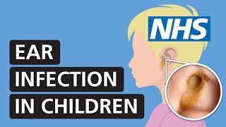 Ear infection in children symptoms and treatment  NHS [upl. by Eimilb836]