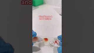 Blood typing process laboratory mls cls medtechstudent medtech blood bloodgroup bloodtype [upl. by Lashondra]