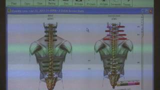 Chiropractic Adjustment Surface EMG Scans amp Spinal Alignment by Dr Madden [upl. by Yelyab]