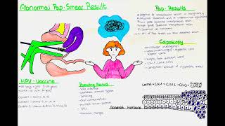 Abnormal PAP Smear Result HPV Infection Cervical Dysplasia  Results Biopsy Conization Vaccines [upl. by Mallon]