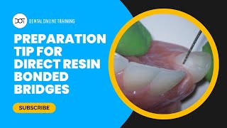 Preparation Tip for Direct Resin Bonded Bridges [upl. by Sarajane281]