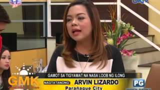 Kapuso Mo Jessica Soho The rare case of poreless skin in four siblings [upl. by Elleret]