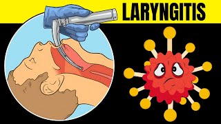 Laryngitis Acute amp Chronic  Causes Signs amp Symptoms Diagnosis And Treatment [upl. by Ahsuatal]